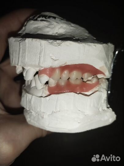 Ремонт съёмных зубных протезов