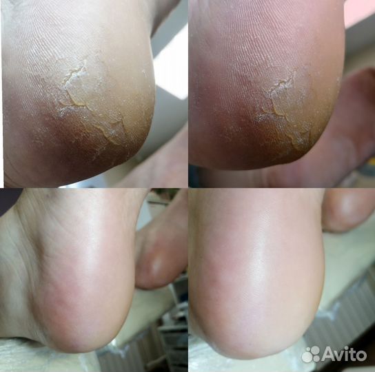 Маникюр. SMART педикюр