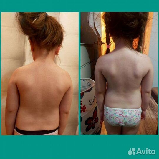 Детский массаж