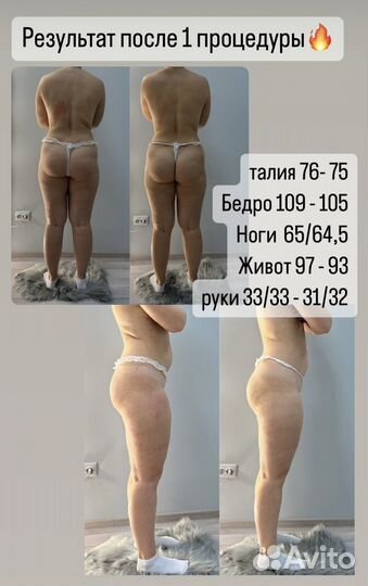 Аппаратный Массаж сферами