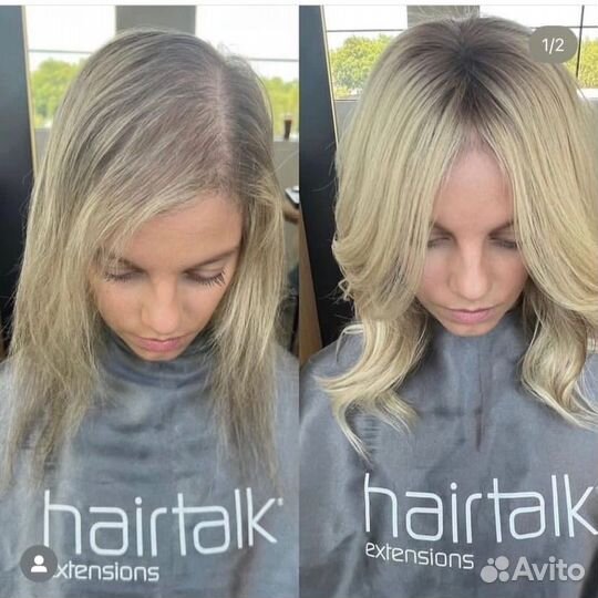 Система замещения волос