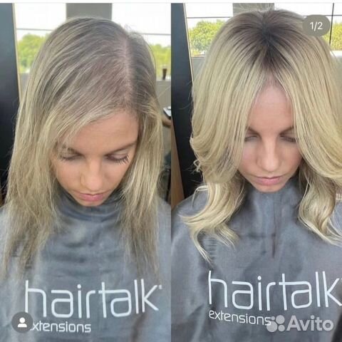 Система замещения волос