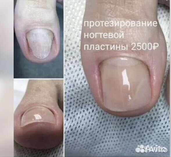 Подолог / Медицинский педикюр и маникюр