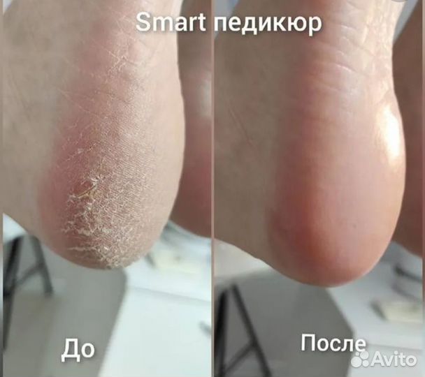 Маникюр/smart педикюр