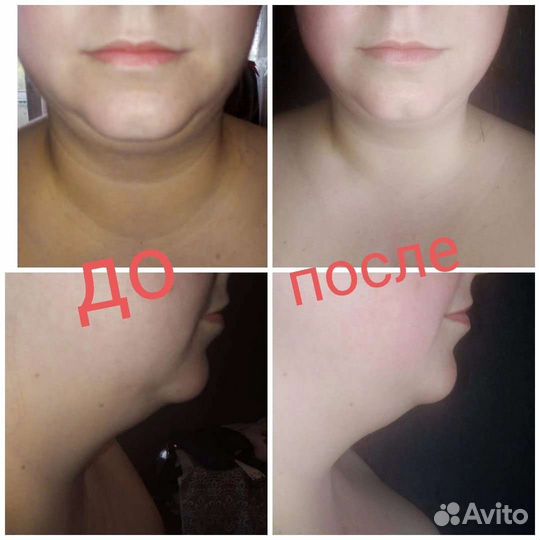 Услуги массажистки