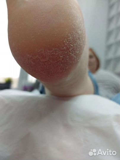 Педикюр модели