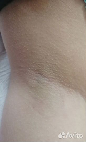 Шугаринг депиляция