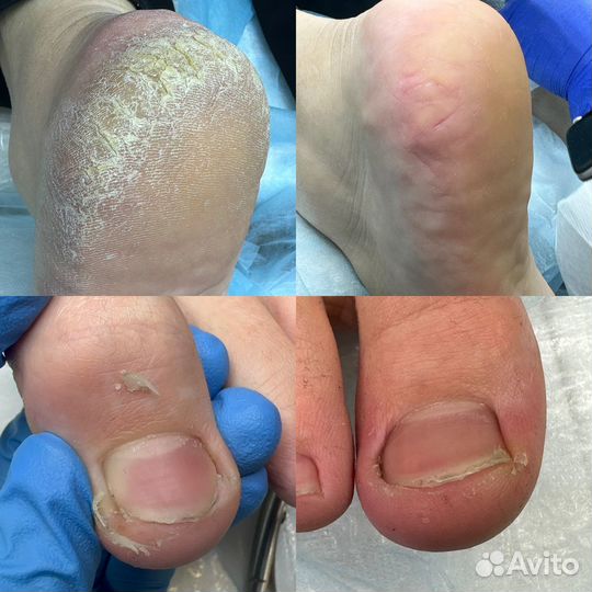 Педикюр с выездом на дом