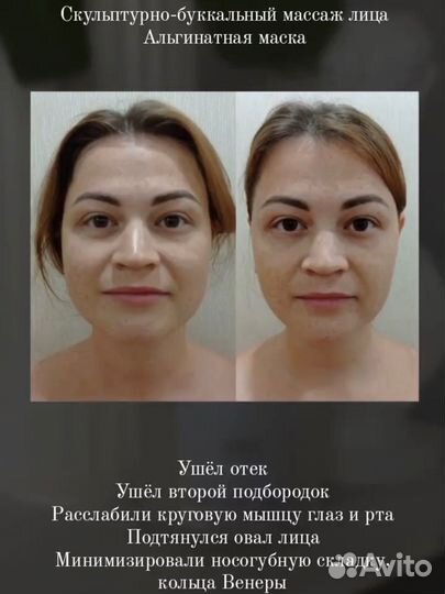 Буккальный массаж лица