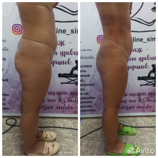 Массаж коррекция фигуры