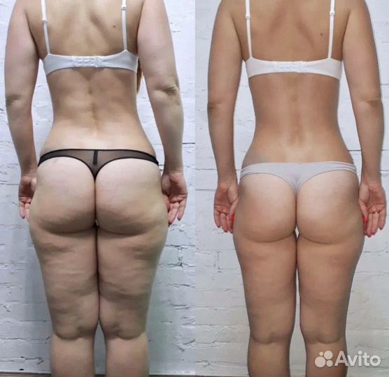 LPG по маслу и костюму