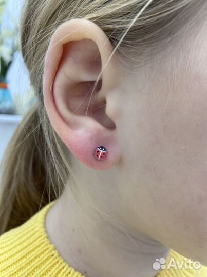 Прокол ушей системой Studex 75