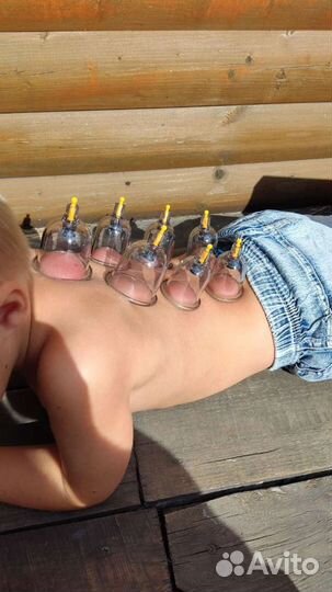 Вакуумные банки 30 шт в чемодане