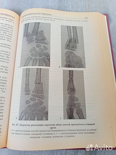 Детская травматология