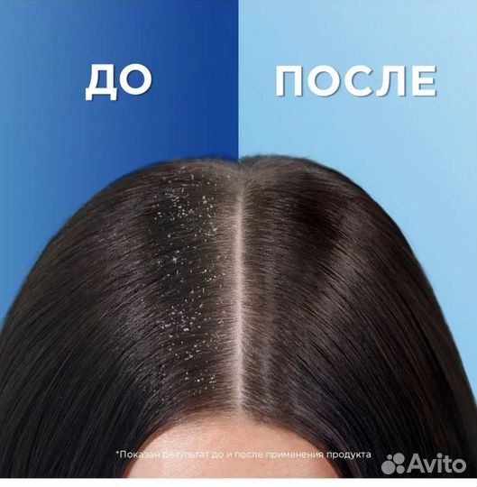 Шампунь дл волос head shoulders оптом