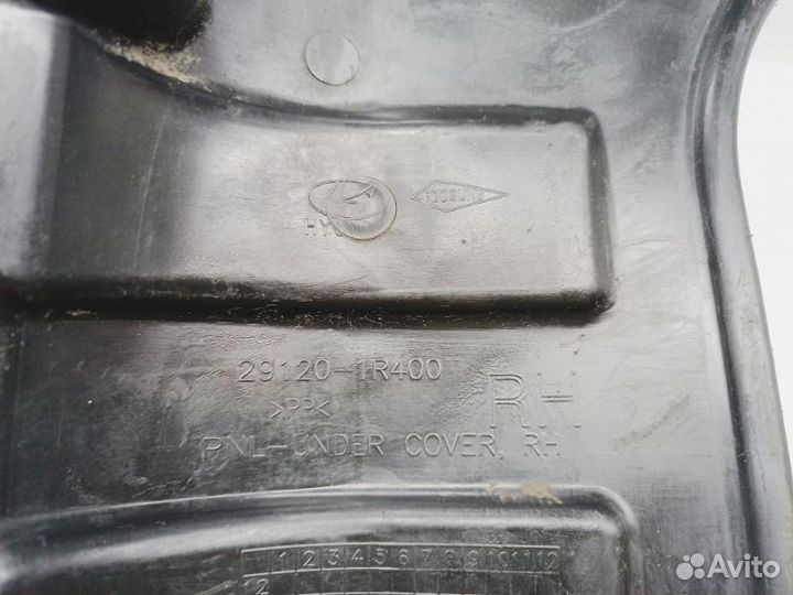 Пыльник двигателя правый Hyundai Solaris RB G4FA