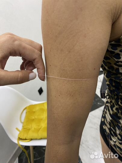 Криолиполиз