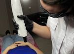Лазерный аппарат для удаления тату и татуажа