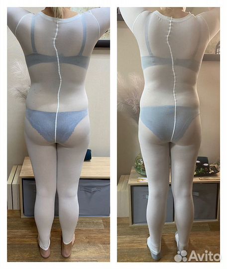 LPG массаж на оригинальном аппарате vortex