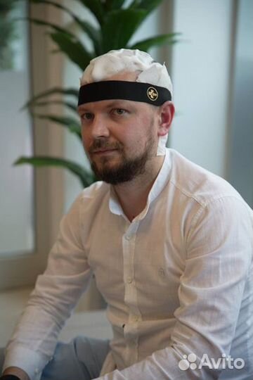 Консультация перед пересадкой волос