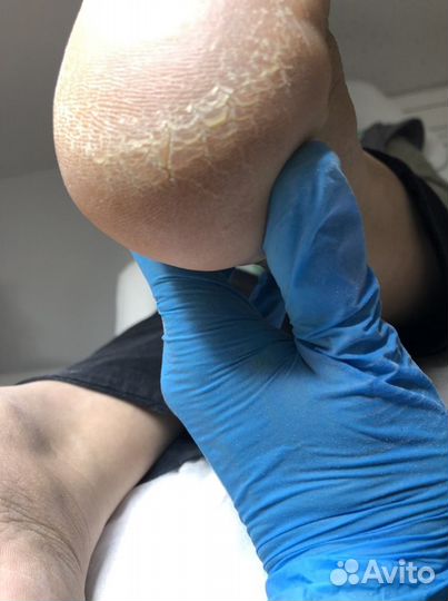 Маникюр и педикюр(смарт педикюр)