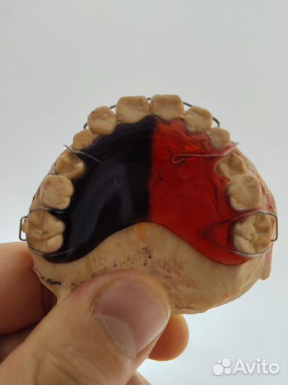 Зубной техник ортодонт