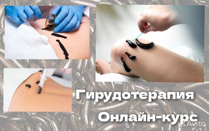 Обучение гирудотерапии