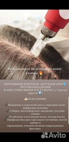 Мезотерапия лица