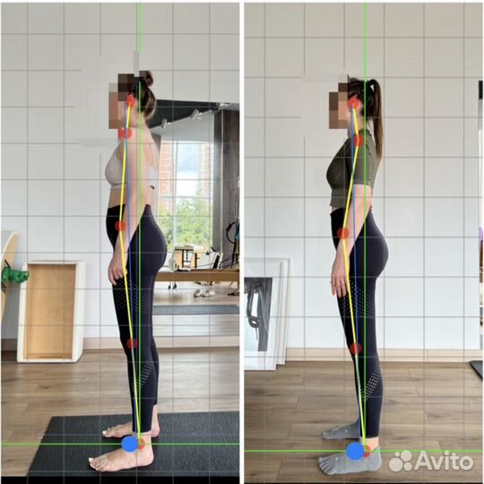 Телесный терапевт, коррекция тела, уберу хрон.боль