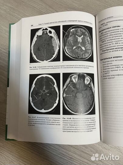 Лучевая диагностика учебник
