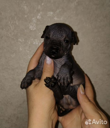 Ксолоитцкуинтли микроб