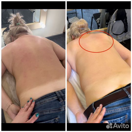 Массаж Луганск