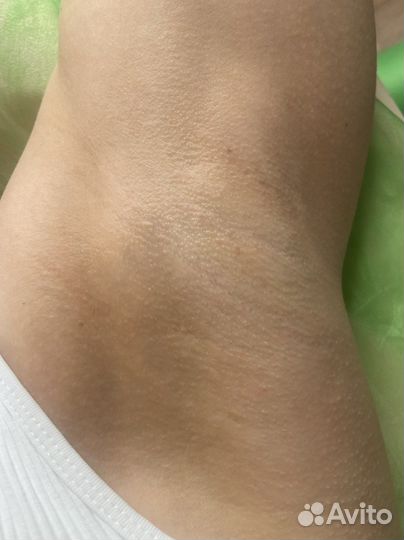 Депиляция воском: глубокое бикини