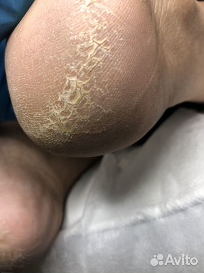 Маникюр и педикюр(смарт педикюр)