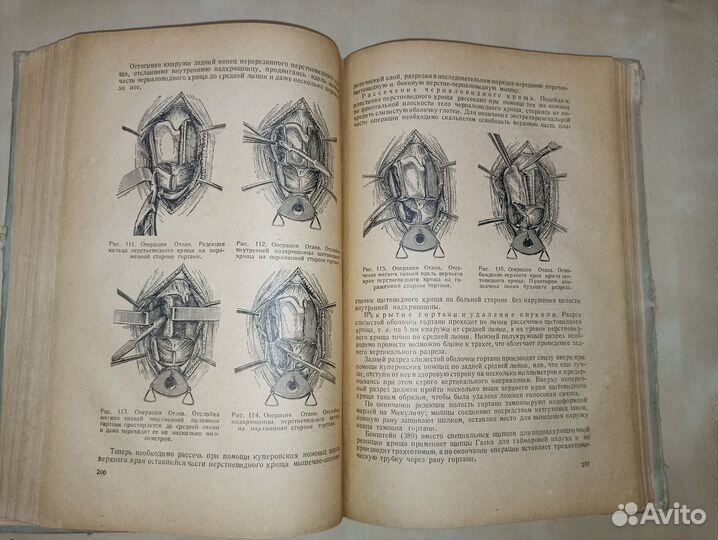 Хирургия верхних дыхательных путей. Зимонт. 1948