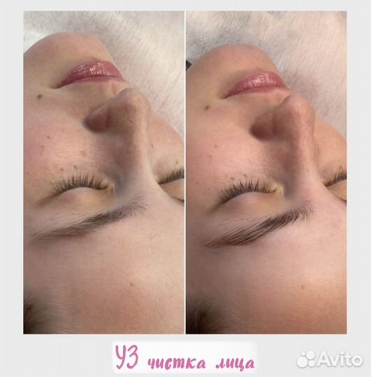 Ультразвуковая чистка