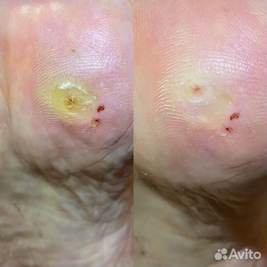 Педикюр, Подолог