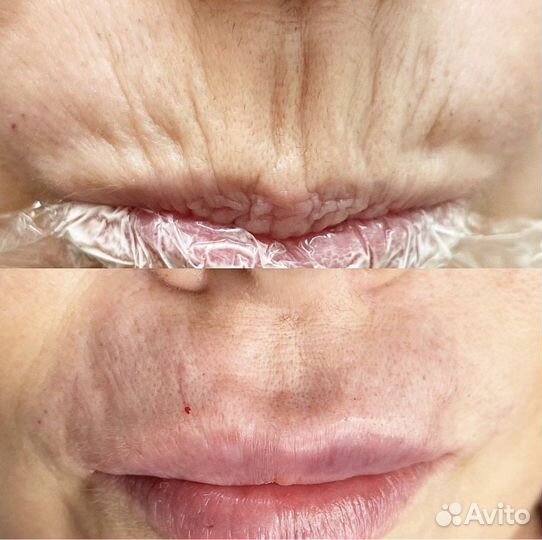 Курсы косметолога