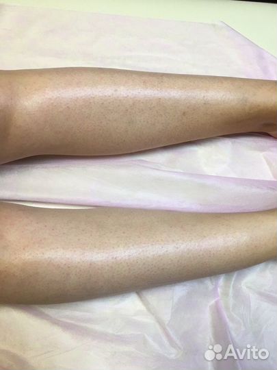 Депиляция воском: глубокое бикини