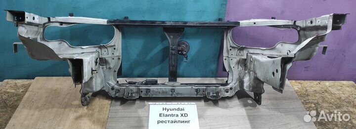 Телевизор Hyundai Elantra XD, рестайлинг, 2005г