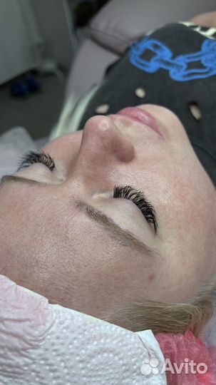 Чистка лица