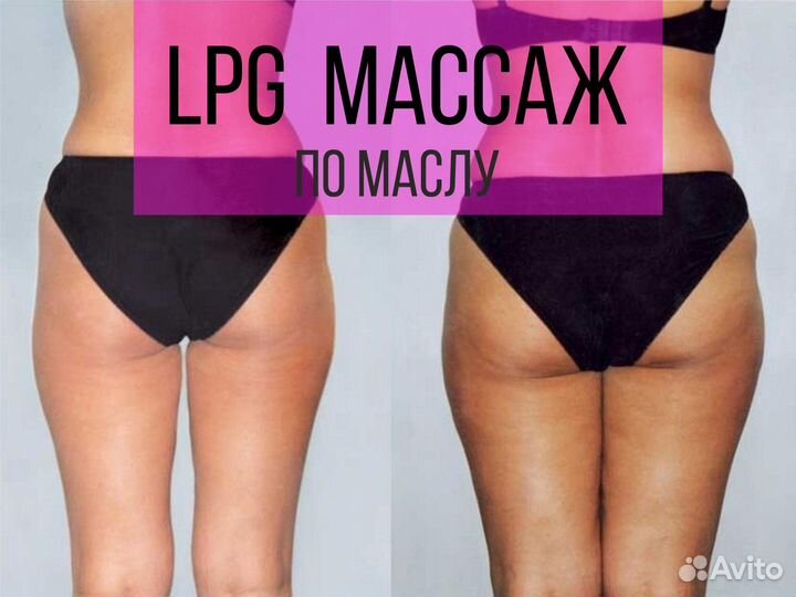 LPG массаж по маслу, антицеллюлитный массаж