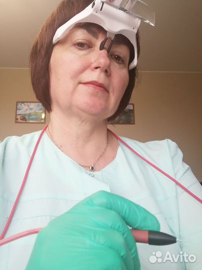 Электроэпиляция