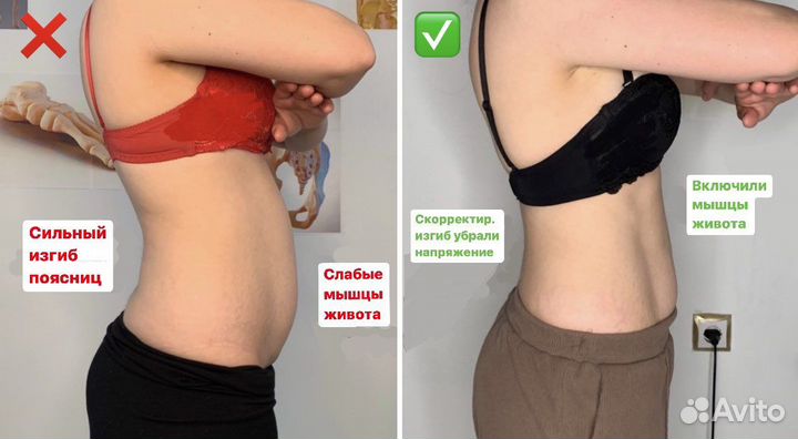 Лечение сколиоза/грыжи/сутулости и др