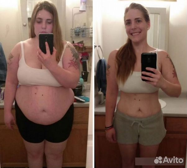 Увеличение губ. Коррекция фигуры