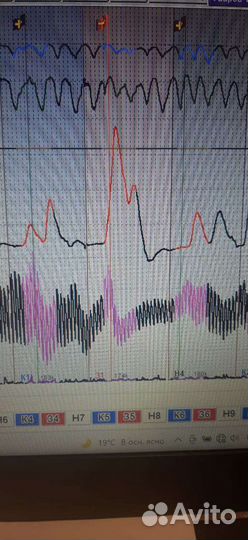 Проверка на детекторе лжи в Москве