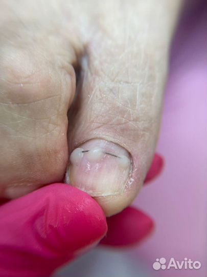 Услуги подолога