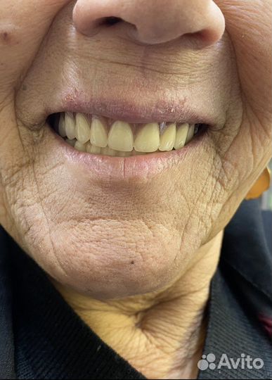 Стоматолог-ортопед