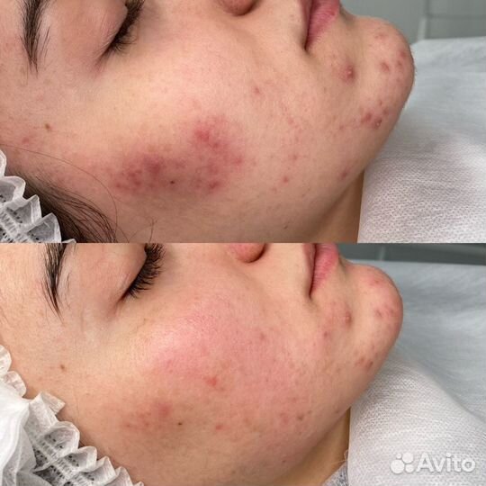 Обучение Косметологии