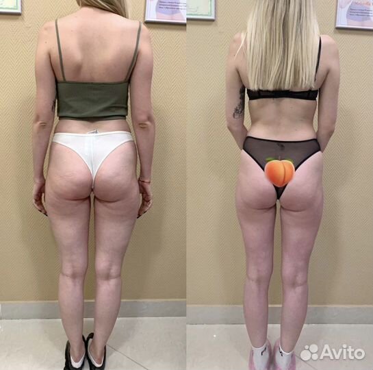 Массаж LPG лица и тела